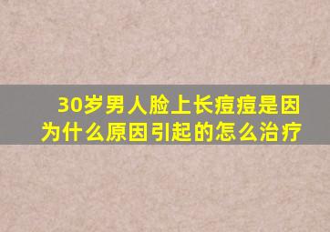 30岁男人脸上长痘痘是因为什么原因引起的怎么治疗