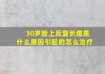 30岁脸上反复长痘是什么原因引起的怎么治疗