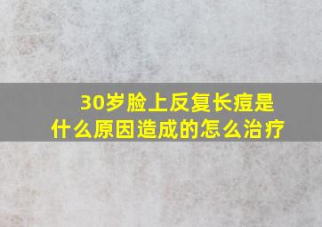 30岁脸上反复长痘是什么原因造成的怎么治疗