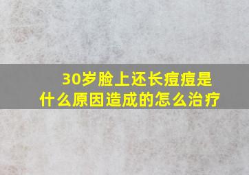 30岁脸上还长痘痘是什么原因造成的怎么治疗