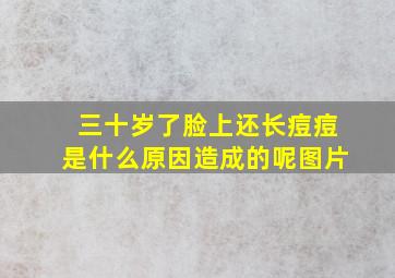 三十岁了脸上还长痘痘是什么原因造成的呢图片