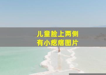 儿童脸上两侧有小疙瘩图片