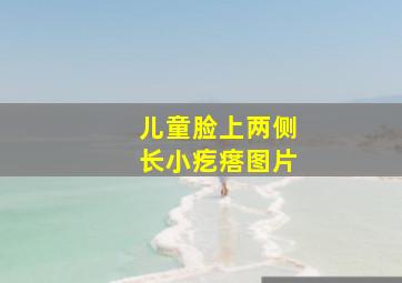 儿童脸上两侧长小疙瘩图片