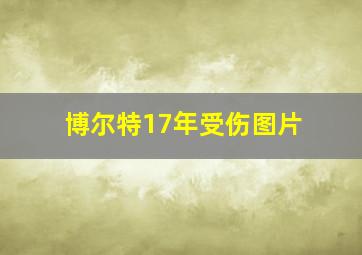 博尔特17年受伤图片