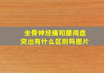 坐骨神经痛和腰间盘突出有什么区别吗图片