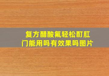 复方醋酸氟轻松酊肛门能用吗有效果吗图片