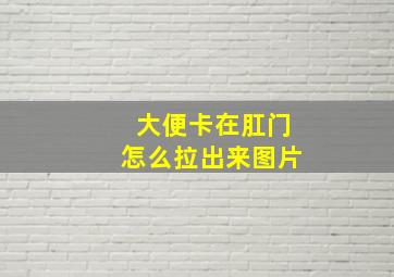 大便卡在肛门怎么拉出来图片