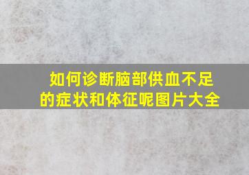 如何诊断脑部供血不足的症状和体征呢图片大全