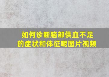 如何诊断脑部供血不足的症状和体征呢图片视频