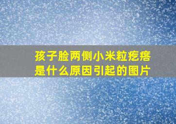 孩子脸两侧小米粒疙瘩是什么原因引起的图片