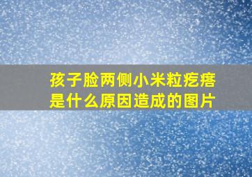 孩子脸两侧小米粒疙瘩是什么原因造成的图片