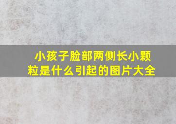 小孩子脸部两侧长小颗粒是什么引起的图片大全