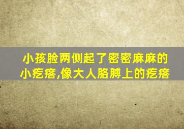 小孩脸两侧起了密密麻麻的小疙瘩,像大人胳膊上的疙瘩