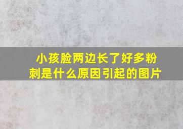 小孩脸两边长了好多粉刺是什么原因引起的图片