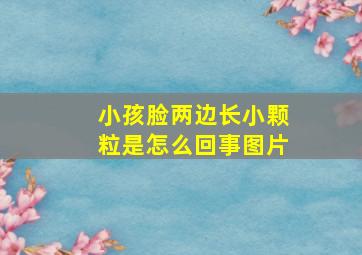 小孩脸两边长小颗粒是怎么回事图片