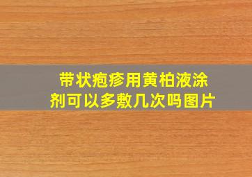 带状疱疹用黄柏液涂剂可以多敷几次吗图片