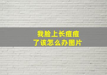 我脸上长痘痘了该怎么办图片