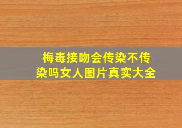 梅毒接吻会传染不传染吗女人图片真实大全