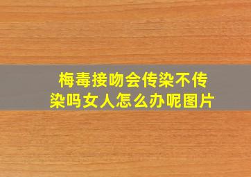 梅毒接吻会传染不传染吗女人怎么办呢图片