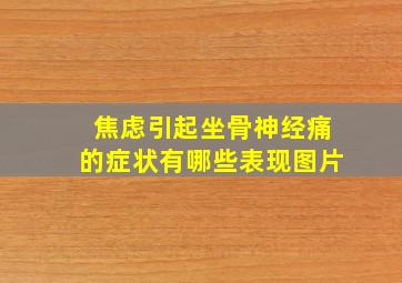 焦虑引起坐骨神经痛的症状有哪些表现图片