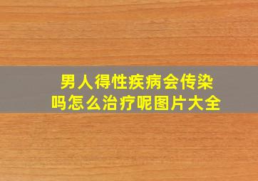 男人得性疾病会传染吗怎么治疗呢图片大全