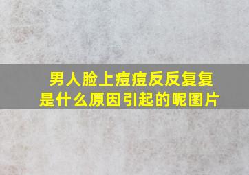 男人脸上痘痘反反复复是什么原因引起的呢图片