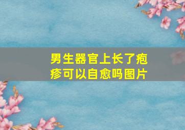 男生器官上长了疱疹可以自愈吗图片