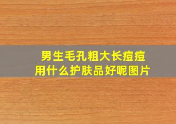 男生毛孔粗大长痘痘用什么护肤品好呢图片