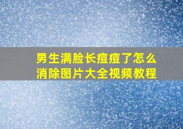 男生满脸长痘痘了怎么消除图片大全视频教程