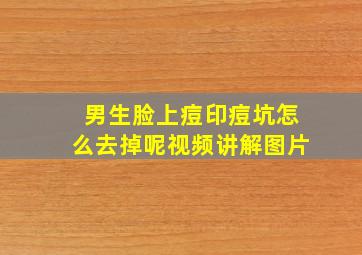 男生脸上痘印痘坑怎么去掉呢视频讲解图片