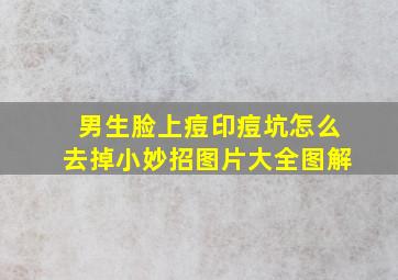 男生脸上痘印痘坑怎么去掉小妙招图片大全图解