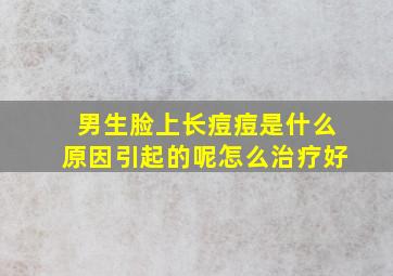 男生脸上长痘痘是什么原因引起的呢怎么治疗好