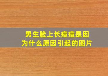 男生脸上长痘痘是因为什么原因引起的图片