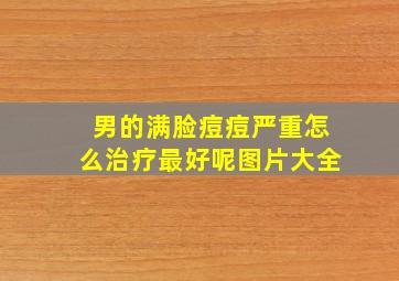 男的满脸痘痘严重怎么治疗最好呢图片大全