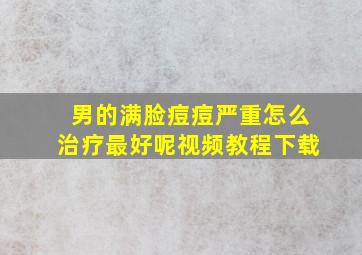 男的满脸痘痘严重怎么治疗最好呢视频教程下载