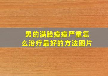 男的满脸痘痘严重怎么治疗最好的方法图片