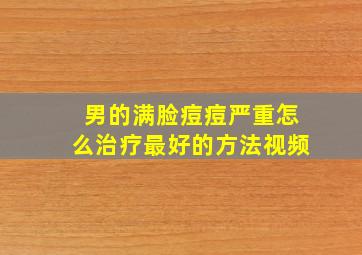 男的满脸痘痘严重怎么治疗最好的方法视频