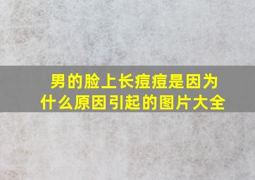 男的脸上长痘痘是因为什么原因引起的图片大全