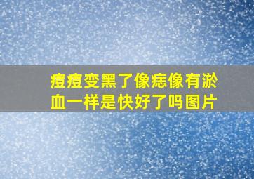 痘痘变黑了像痣像有淤血一样是快好了吗图片