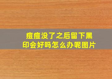 痘痘没了之后留下黑印会好吗怎么办呢图片