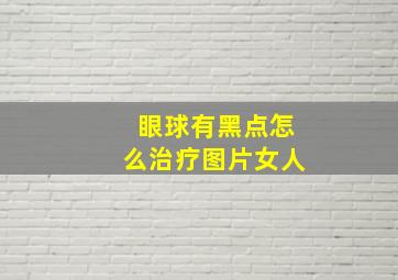 眼球有黑点怎么治疗图片女人