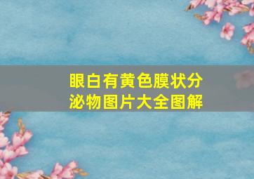 眼白有黄色膜状分泌物图片大全图解