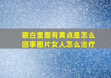 眼白里面有黄点是怎么回事图片女人怎么治疗