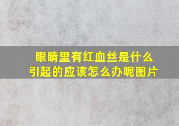 眼睛里有红血丝是什么引起的应该怎么办呢图片