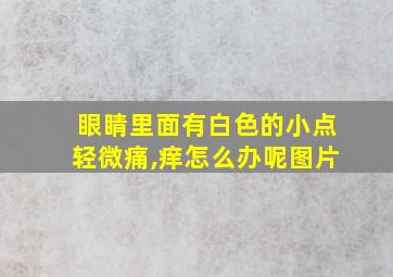 眼睛里面有白色的小点轻微痛,痒怎么办呢图片