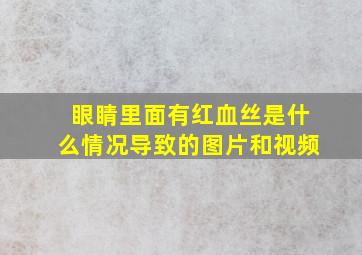 眼睛里面有红血丝是什么情况导致的图片和视频