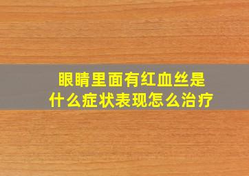 眼睛里面有红血丝是什么症状表现怎么治疗