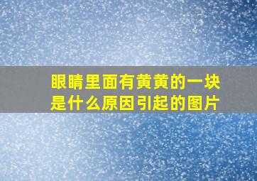 眼睛里面有黄黄的一块是什么原因引起的图片