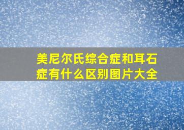 美尼尔氏综合症和耳石症有什么区别图片大全