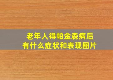 老年人得帕金森病后有什么症状和表现图片